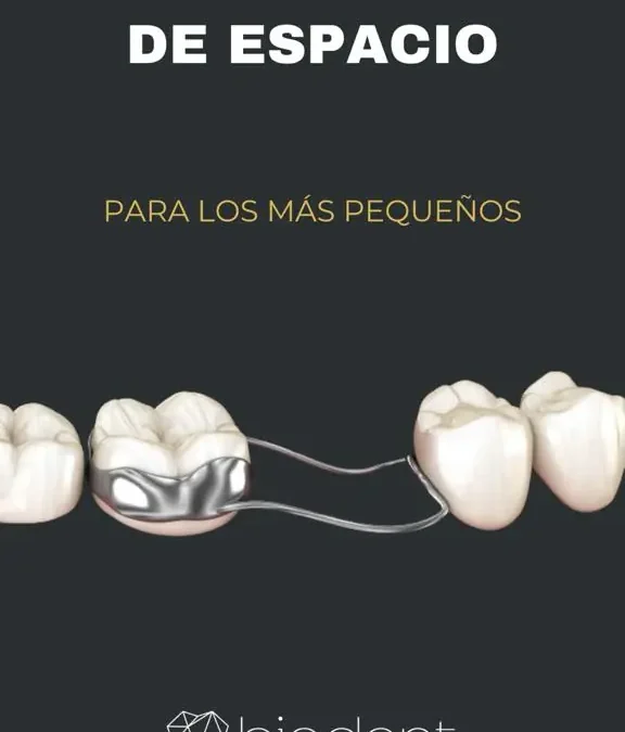 Mantenedores de espacio: ¿Qué son y para qué sirven?